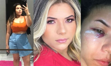 Influencer denuncia que foi agredida pelo marido policial.